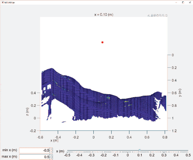 Figure 4 for Radar Positioning for Accurate Sensing of Pulse Waves at Multiple Sites Using a 3D Human Model