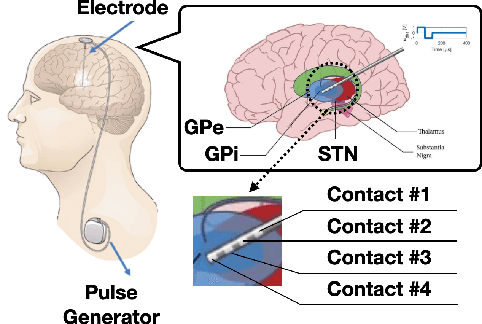 Figure 1 for Offline Learning of Closed-Loop Deep Brain Stimulation Controllers for Parkinson Disease Treatment