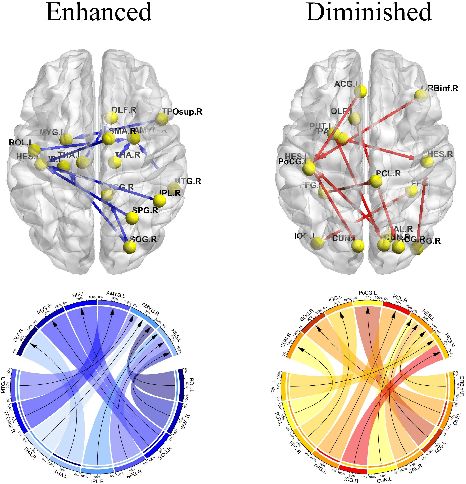 Figure 2 for Multi-resolution Spatiotemporal Enhanced Transformer Denoising with Functional Diffusive GANs for Constructing Brain Effective Connectivity in MCI analysis