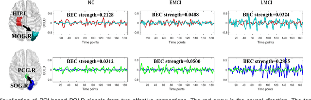 Figure 4 for Multi-resolution Spatiotemporal Enhanced Transformer Denoising with Functional Diffusive GANs for Constructing Brain Effective Connectivity in MCI analysis