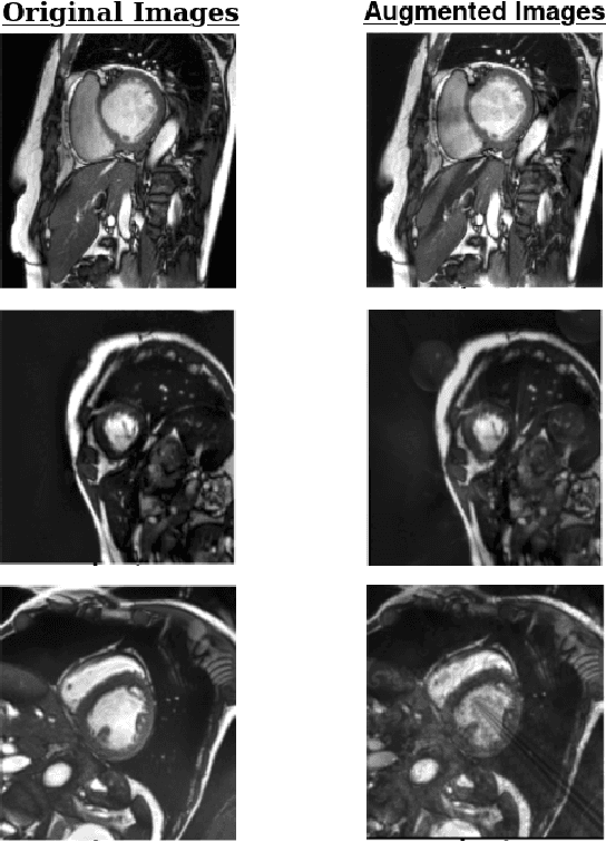 Figure 1 for Complex Style Image Transformations for Domain Generalization in Medical Images