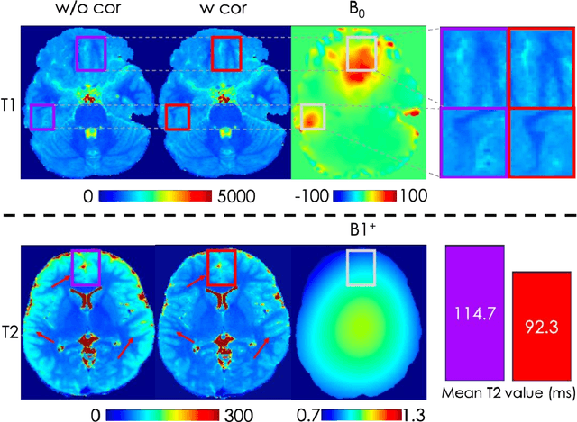 Figure 4 for Sequence adaptive field-imperfection estimation (SAFE): retrospective estimation and correction of $B_1^+$ and $B_0$ inhomogeneities for enhanced MRF quantification