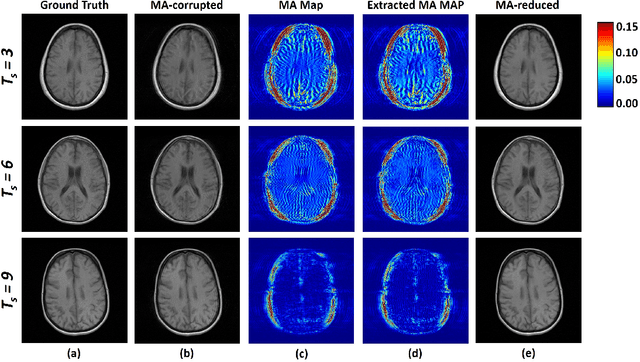Figure 3 for UNAEN: Unsupervised Abnomality Extraction Network for MRI Motion Artifact Reduction