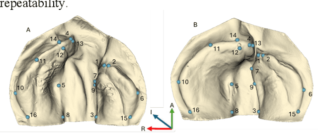 Figure 1 for Geometric Deep Learning for Automated Landmarking of Maxillary Arches on 3D Oral Scans from Newborns with Cleft Lip and Palate