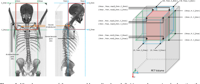 Figure 3 for Segmentation-Free Outcome Prediction in Head and Neck Cancer: Deep Learning-based Feature Extraction from Multi-Angle Maximum Intensity Projections (MA-MIPs) of PET Images