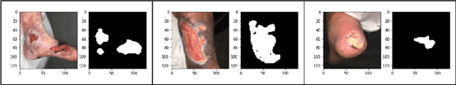 Figure 2 for Deep Learning for Automated Wound Classification And Segmentation