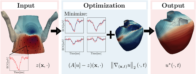 Figure 1 for Finite element-based space-time total variation-type regularization of the inverse problem in electrocardiographic imaging