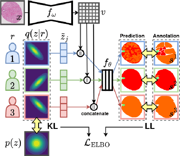 Figure 1 for Probabilistic Modeling of Inter- and Intra-observer Variability in Medical Image Segmentation