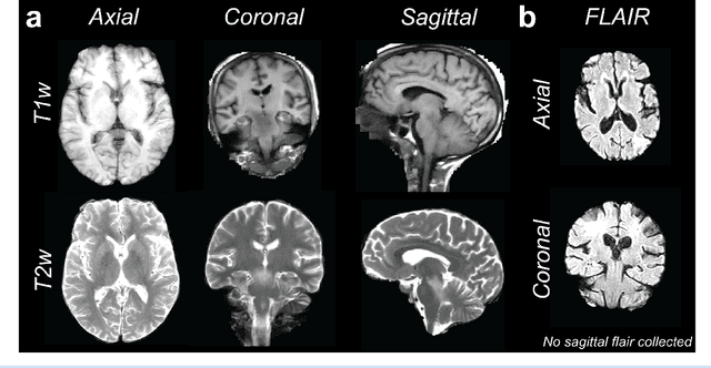 Figure 4 for A labeled Clinical-MRI dataset of Nigerian brains