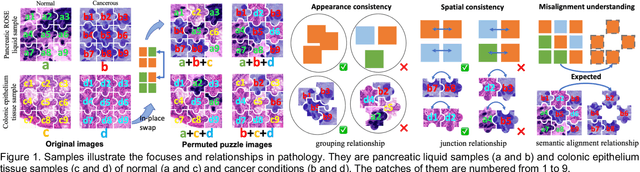 Figure 1 for PuzzleTuning: Explicitly Bridge Pathological and Natural Image with Puzzles