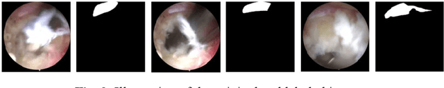 Figure 3 for Spinal nerve segmentation method and dataset construction in endoscopic surgical scenarios