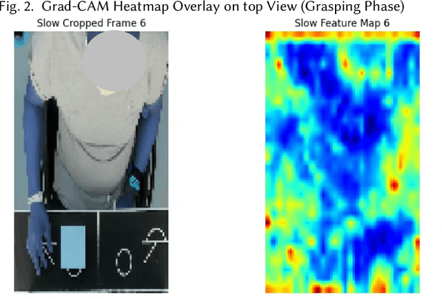 Figure 3 for Automated ARAT Scoring Using Multimodal Video Analysis, Multi-View Fusion, and Hierarchical Bayesian Models: A Clinician Study