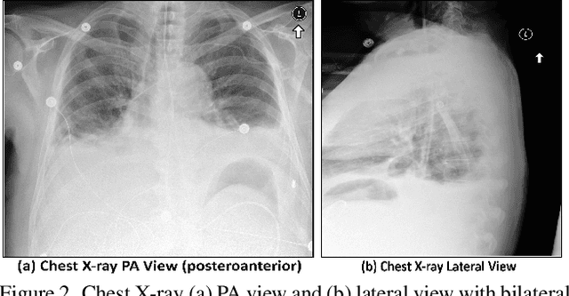 Figure 3 for Trustworthy Medical Imaging with Large Language Models: A Study of Hallucinations Across Modalities