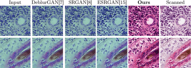 Figure 4 for Rethinking Histology Slide Digitization Workflows for Low-Resource Settings