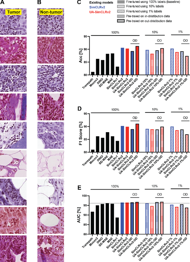 Figure 3 for Contrastive Deep Encoding Enables Uncertainty-aware Machine-learning-assisted Histopathology