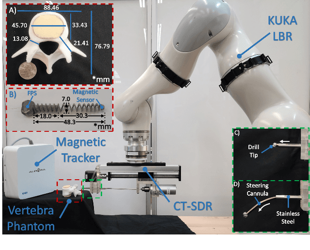 Figure 2 for Spatial Spinal Fixation: A Transformative Approach Using a Unique Robot-Assisted Steerable Drilling System and Flexible Pedicle Screw