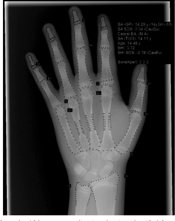 Figure 3 for Current State of Community-Driven Radiological AI Deployment in Medical Imaging