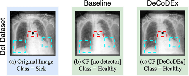 Figure 1 for DeCoDEx: Confounder Detector Guidance for Improved Diffusion-based Counterfactual Explanations