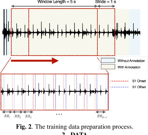 Figure 3 for Model-driven Heart Rate Estimation and Heart Murmur Detection based on Phonocardiogram