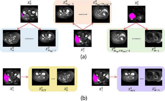 Figure 3 for FS-MedSAM2: Exploring the Potential of SAM2 for Few-Shot Medical Image Segmentation without Fine-tuning