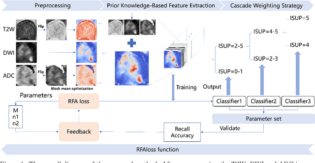 Figure 1 for Enhanced Cascade Prostate Cancer Classifier in mp-MRI Utilizing Recall Feedback Adaptive Loss and Prior Knowledge-Based Feature Extraction