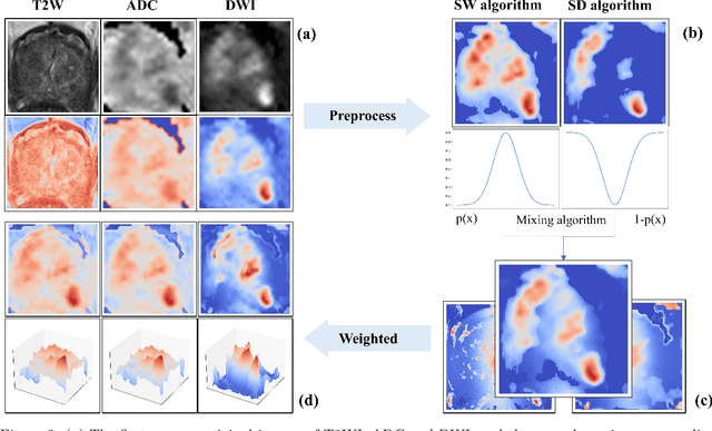 Figure 3 for Enhanced Cascade Prostate Cancer Classifier in mp-MRI Utilizing Recall Feedback Adaptive Loss and Prior Knowledge-Based Feature Extraction