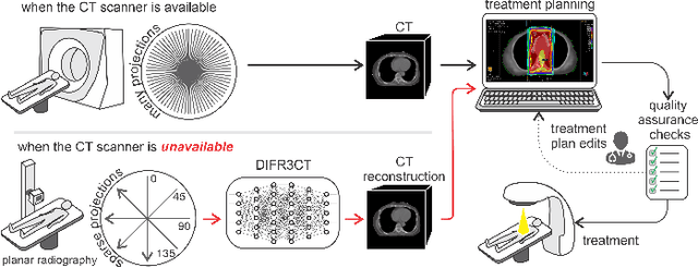 Figure 1 for DIFR3CT: Latent Diffusion for Probabilistic 3D CT Reconstruction from Few Planar X-Rays