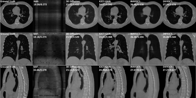 Figure 4 for DIFR3CT: Latent Diffusion for Probabilistic 3D CT Reconstruction from Few Planar X-Rays