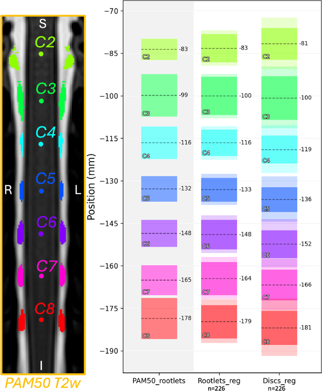 Figure 2 for Rootlets-based registration to the spinal cord PAM50 template