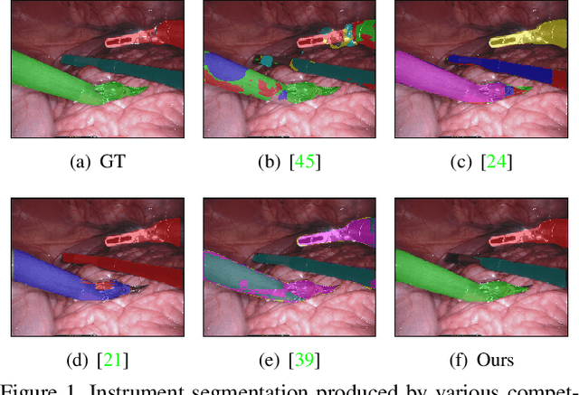 Figure 1 for From Forks to Forceps: A New Framework for Instance Segmentation of Surgical Instruments