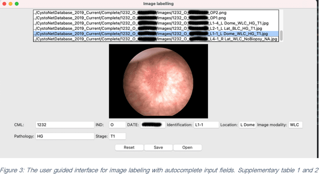 Figure 4 for Conceptual Framework and Documentation Standards of Cystoscopic Media Content for Artificial Intelligence