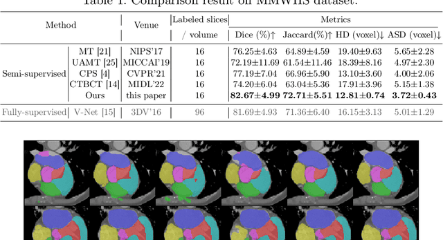 Figure 2 for 3D Medical Image Segmentation with Sparse Annotation via Cross-Teaching between 3D and 2D Networks