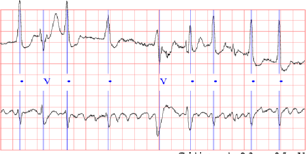 Figure 2 for Exploiting FPGA Capabilities for Accelerated Biomedical Computing