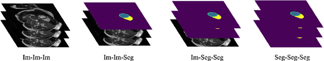 Figure 2 for An investigation into the causes of race bias in AI-based cine CMR segmentation