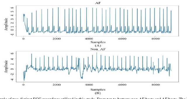 Figure 3 for DeepBoost-AF: A Novel Unsupervised Feature Learning and Gradient Boosting Fusion for Robust Atrial Fibrillation Detection in Raw ECG Signals