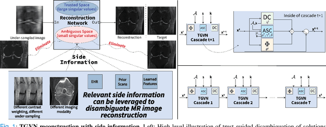 Figure 1 for A Trust-Guided Approach to MR Image Reconstruction with Side Information