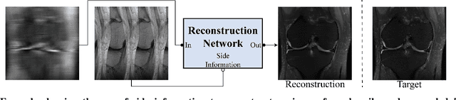 Figure 2 for A Trust-Guided Approach to MR Image Reconstruction with Side Information