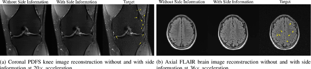 Figure 3 for A Trust-Guided Approach to MR Image Reconstruction with Side Information