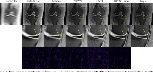 Figure 4 for A Trust-Guided Approach to MR Image Reconstruction with Side Information