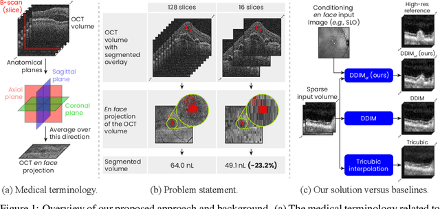 Figure 1 for Conditioning 3D Diffusion Models with 2D Images: Towards Standardized OCT Volumes through En Face-Informed Super-Resolution