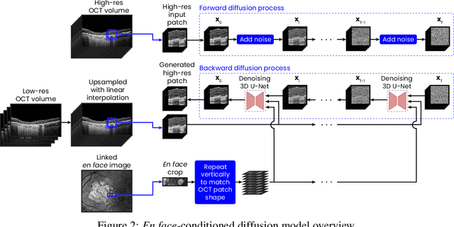 Figure 3 for Conditioning 3D Diffusion Models with 2D Images: Towards Standardized OCT Volumes through En Face-Informed Super-Resolution