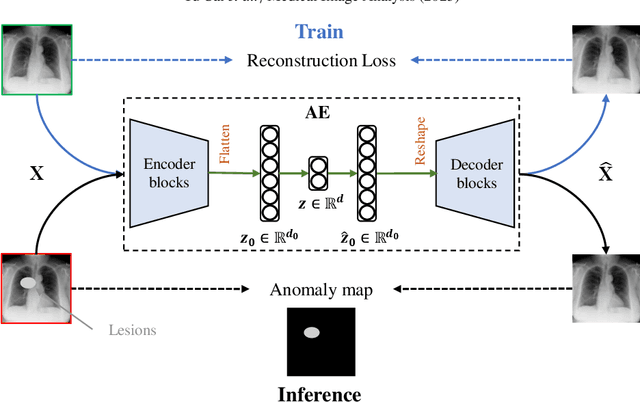 Figure 2 for MedIAnomaly: A comparative study of anomaly detection in medical images