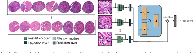 Figure 1 for Attention-based Multiple Instance Learning for Survival Prediction on Lung Cancer Tissue Microarrays