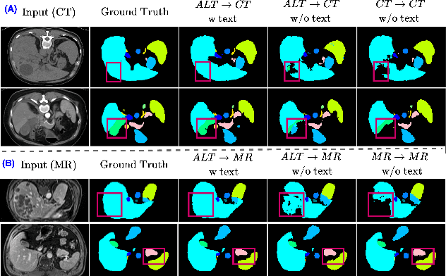 Figure 4 for MulModSeg: Enhancing Unpaired Multi-Modal Medical Image Segmentation with Modality-Conditioned Text Embedding and Alternating Training