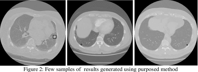 Figure 2 for Lung Nodule-SSM: Self-Supervised Lung Nodule Detection and Classification in Thoracic CT Images