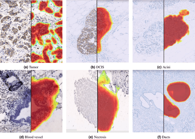 Figure 2 for Multi-Stain Multi-Level Convolutional Network for Multi-Tissue Breast Cancer Image Segmentation