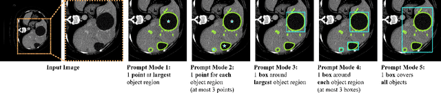 Figure 2 for Segment Anything Model for Medical Image Analysis: an Experimental Study