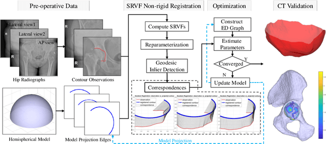 Figure 1 for 3D Acetabular Surface Reconstruction from 2D Pre-operative X-ray Images using SRVF Elastic Registration and Deformation Graph