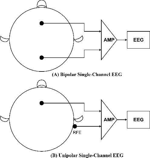 Figure 2 for A Tale of Single-channel Electroencephalogram: Devices, Datasets, Signal Processing, Applications, and Future Directions