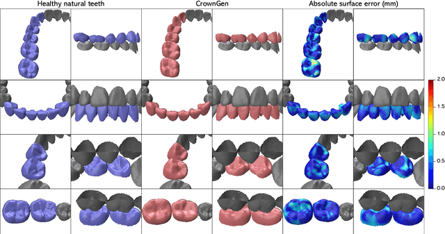Figure 1 for CrownGen: Patient-customized Crown Generation via Point Diffusion Model